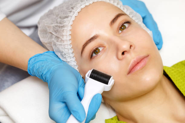 "Top 5 Places for Microneedling Near Me" 2 istockphoto 701234060 612x612 1